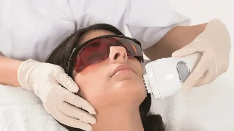 Benefits of Laser Hair Removal